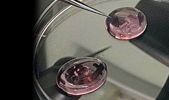 絨毛検査・羊水検査